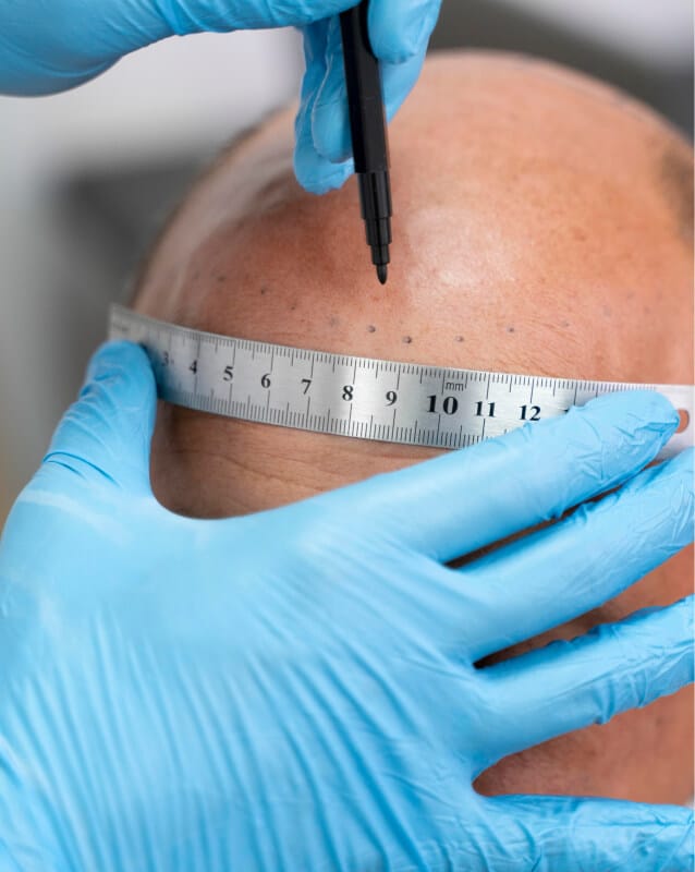 Mögliche Einsatzbereiche der Haarpigmentierung – vielseitige Anwendung für unterschiedliche Haarsituationen